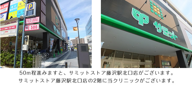 50m程進みますと、サミットストア藤沢駅北口店がございます。サミットストア藤沢駅北口店の2階に当クリニックがございます。